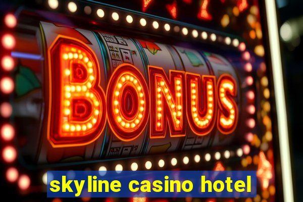 skyline casino hotel